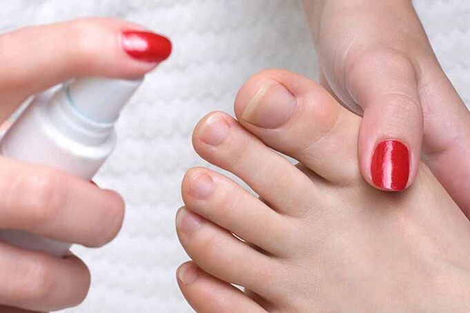 Spray para hongos en las uñas de los pies