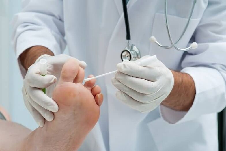 Si tienes síntomas de hongos en las uñas de los pies, debes consultar a un dermatólogo o micólogo. 